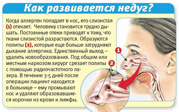 Постоянно заложен нос без насморка: что делать, как лечить, причины, лечение, у ребенка и взрослого