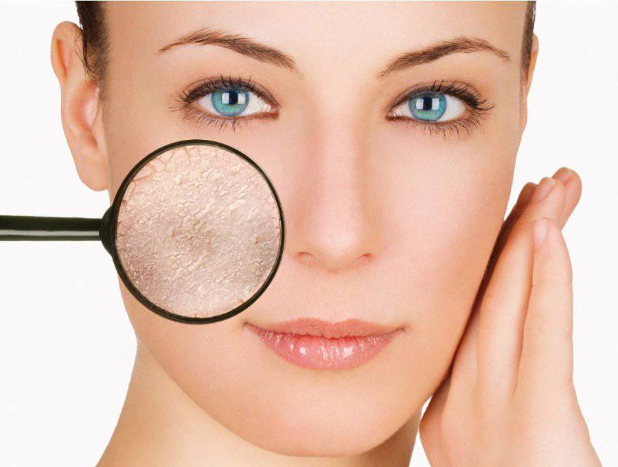 Сухая кожа лица: причина сухости кожи, лечение ксероза, выбор крема и масок при сухой коже