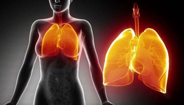 Пневмония у взрослых – причины возникновения, как развивается воспаление легких