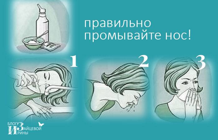 Чем промывать нос при насморке (в домашних условиях)