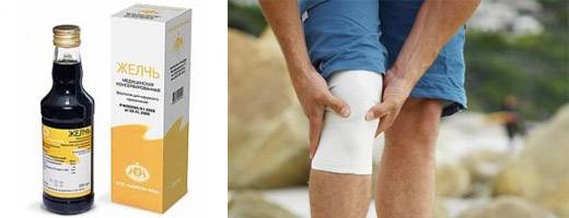 Артроз коленного сустава: лечение народными средствами в домашних условиях