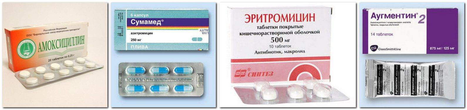 Антибиотики при ангине у взрослого в таблетках: выбор, применение