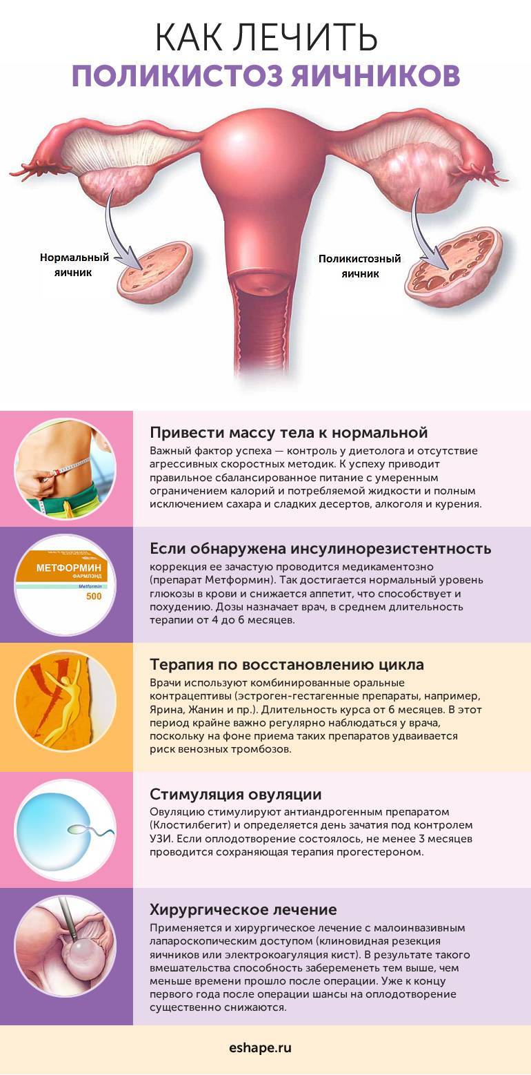 Воспаление яичников у женщин: симптомы, лечение в домашних условиях
