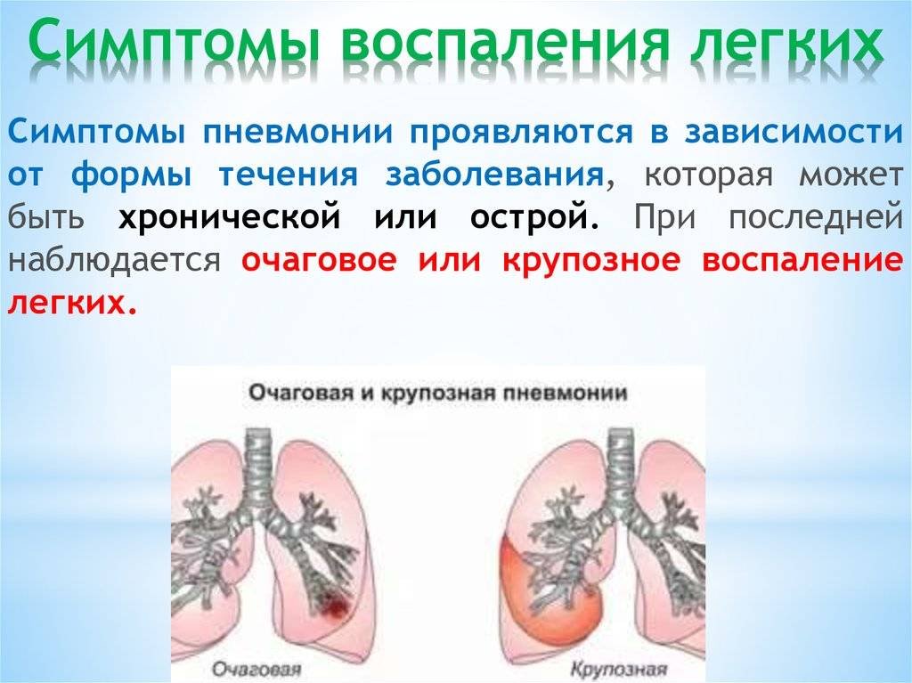 Смерть от пневмонии - причины летального исхода при воспалении легких