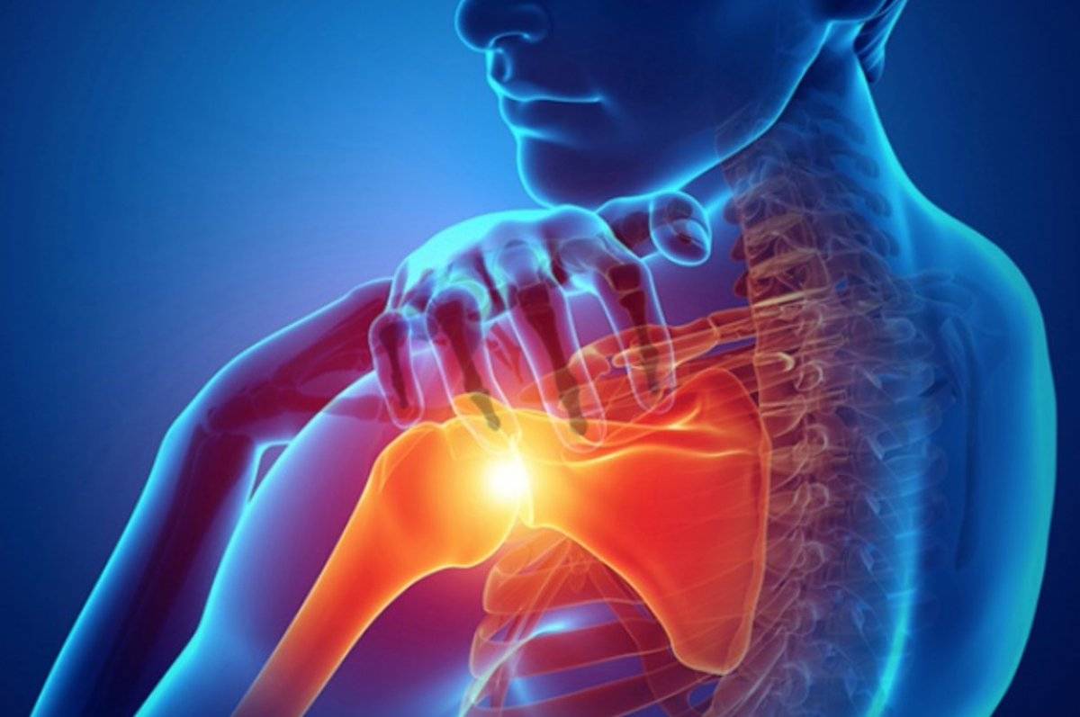 Лечение плечевого периартрита народными средствами | лечение суставов