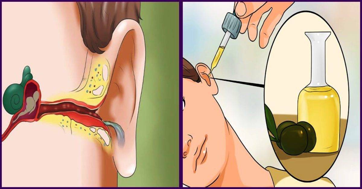 Заложенность ушей при простуде лечение