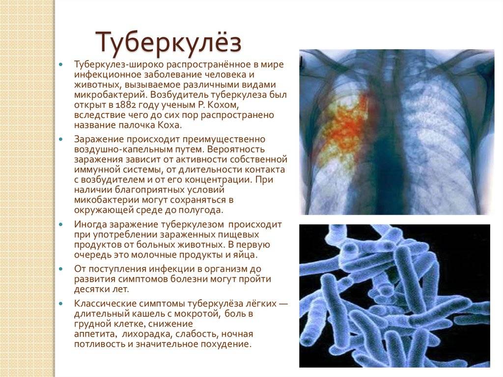 Открытая форма туберкулеза - признаки на ранних стадиях у взрослых, риск заражения формы для окружающих, заразен или нет, как можно заразиться