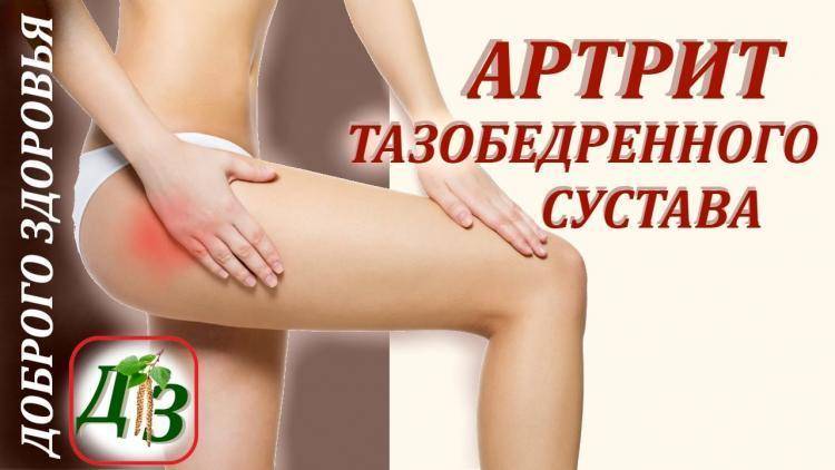 Народные методы лечения артрита тазобедренного сустава