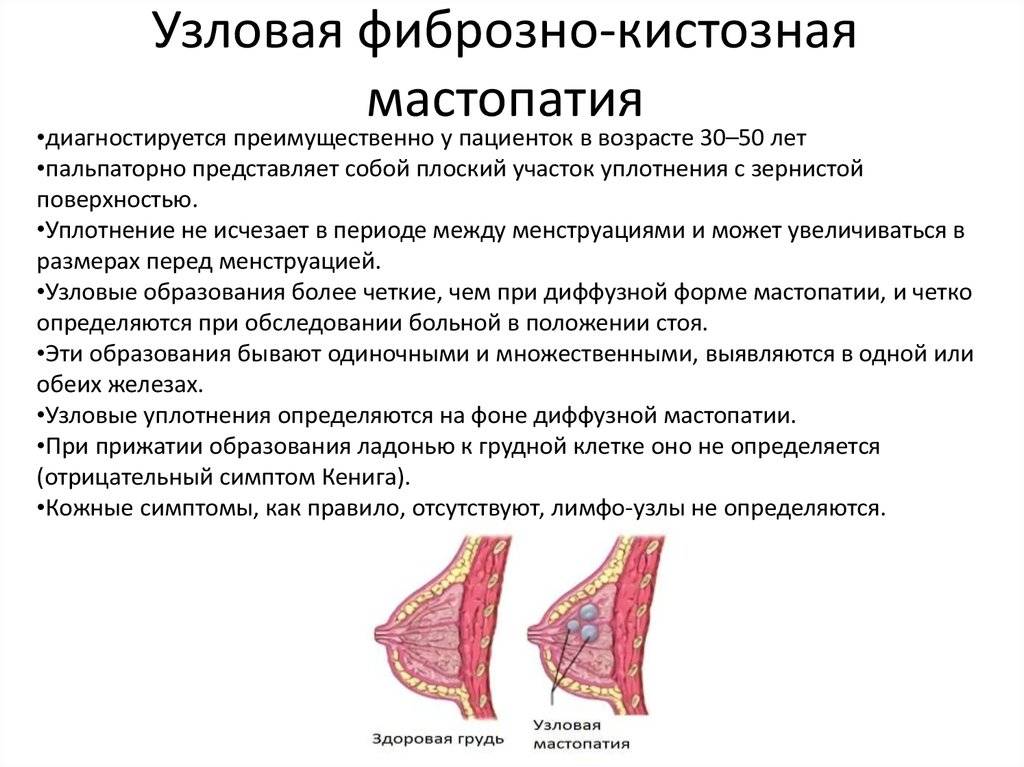ᐉ мастопатия во время климакса симптомы лечение - sp-medic.ru