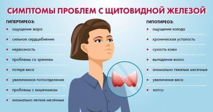 Тиреотоксикоз щитовидной железы - симптомы у женщин, лечение и питание