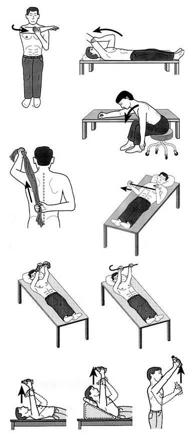 Первая помощь при вывихе плеча и лечение плечевого сустава после травмы, реабилитация
