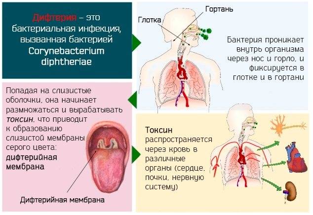 Пневмония - пути передачи и заражения, как переносится, как передается специфическая