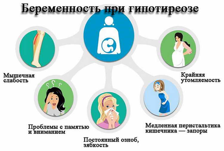 Гипотиреоз: симптомы, диагностика, лечение - поиск врачей и клиник в москве