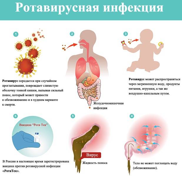 Кишечная инфекция у детей симптомы и лечение — proinfekcii.ru