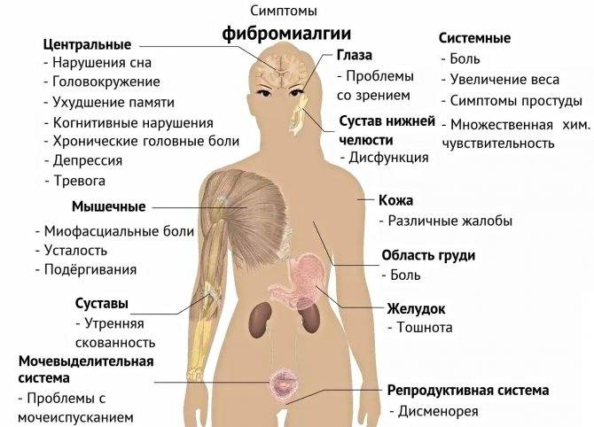 Что такое миалгия? - центр медицины краснодара