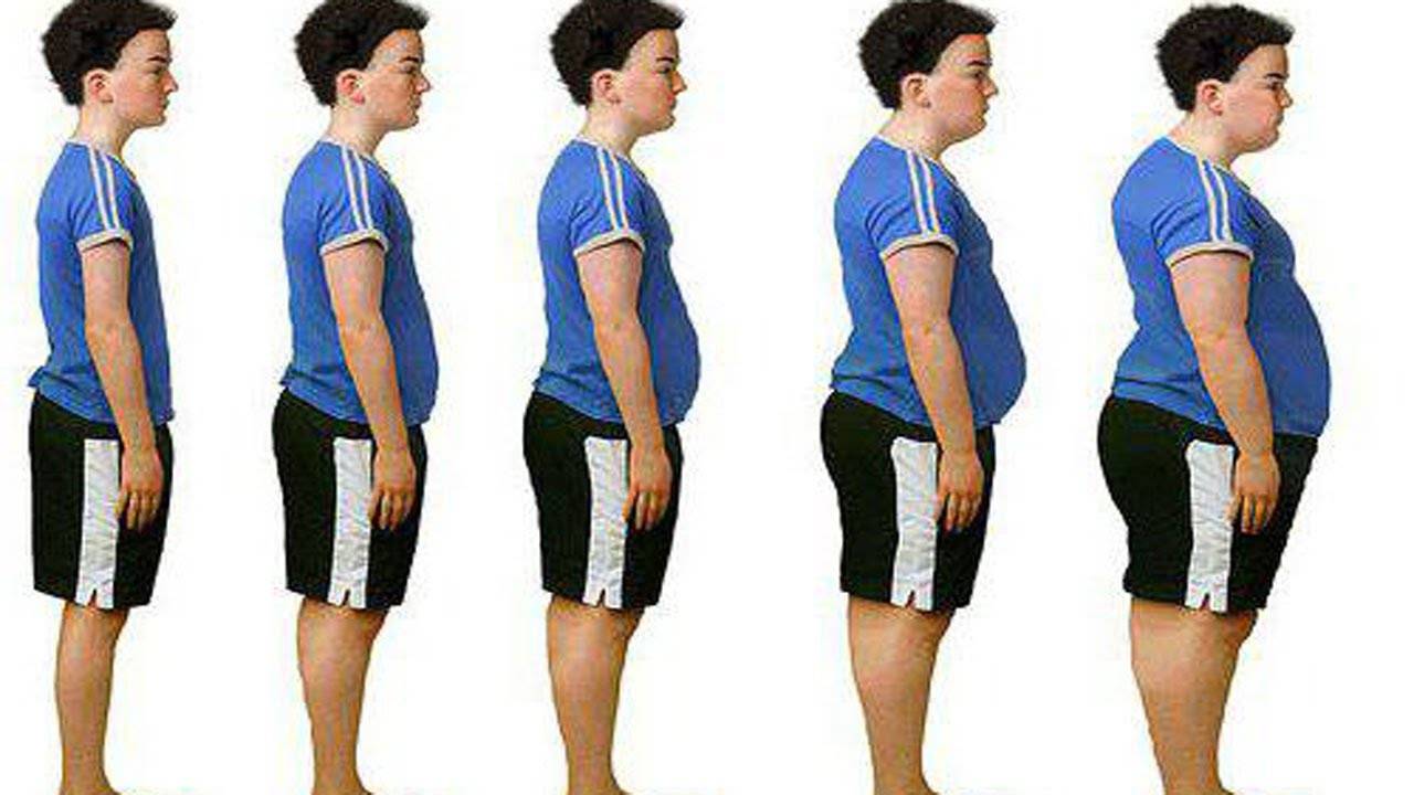 Алиментарное ожирение: что это такое, причины, симптомы, лечение