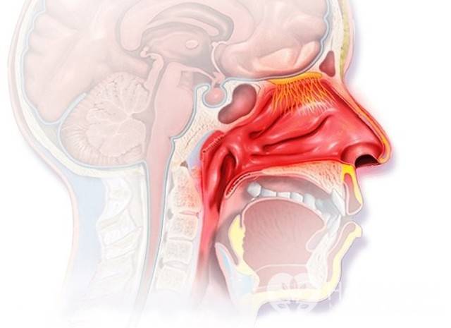 Хронический ринит (вазомоторный, гипертрофический, катаральный). лечение заложенного носа.