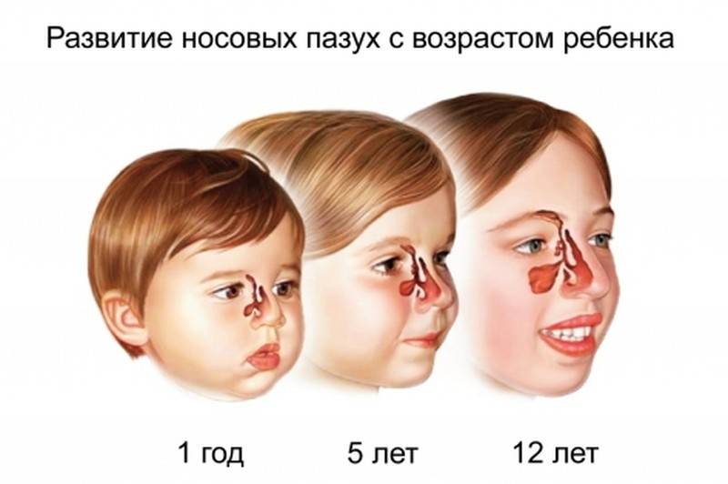 Острый аденоидит у детей: симптомы и лечение pulmono.ru
острый аденоидит у детей: симптомы и лечение