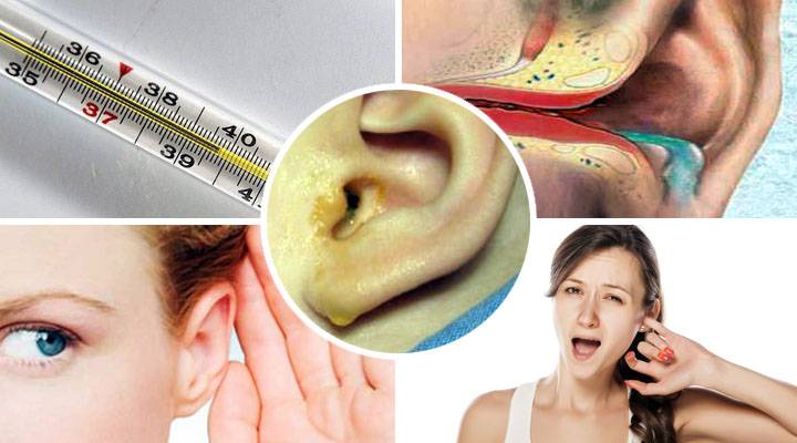 Как лечить отит – как быстро вылечить воспаление среднего уха
