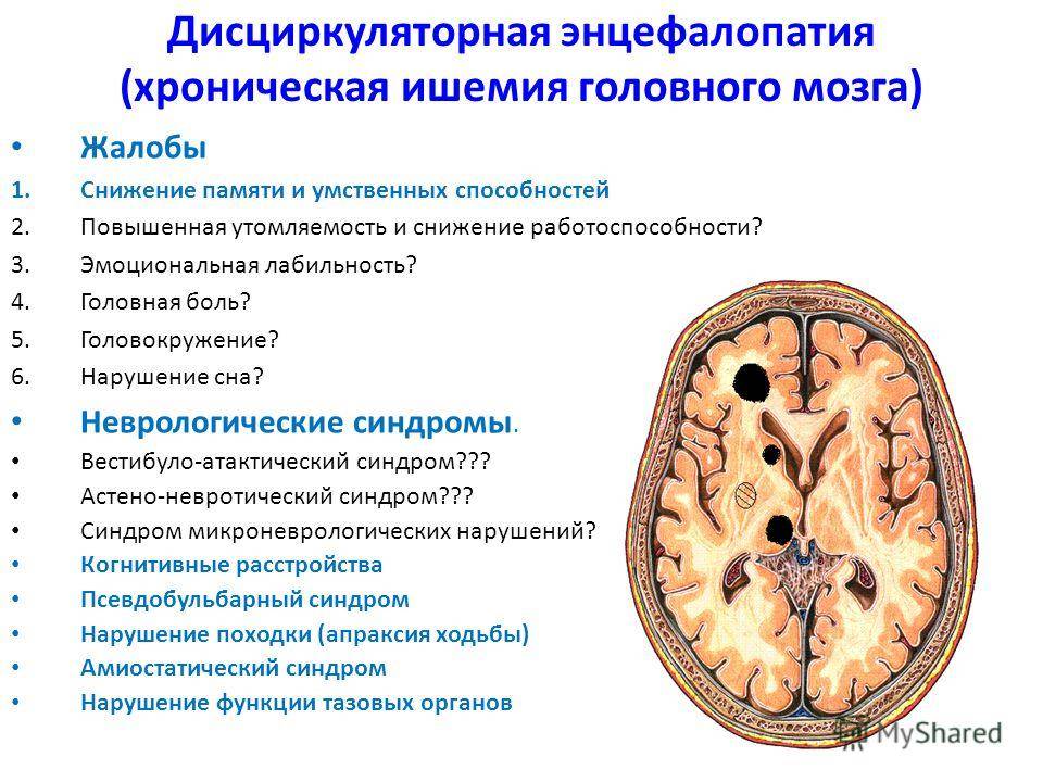 Лечение энцефалопатии головного мозга: препараты, народные средства и другие методики