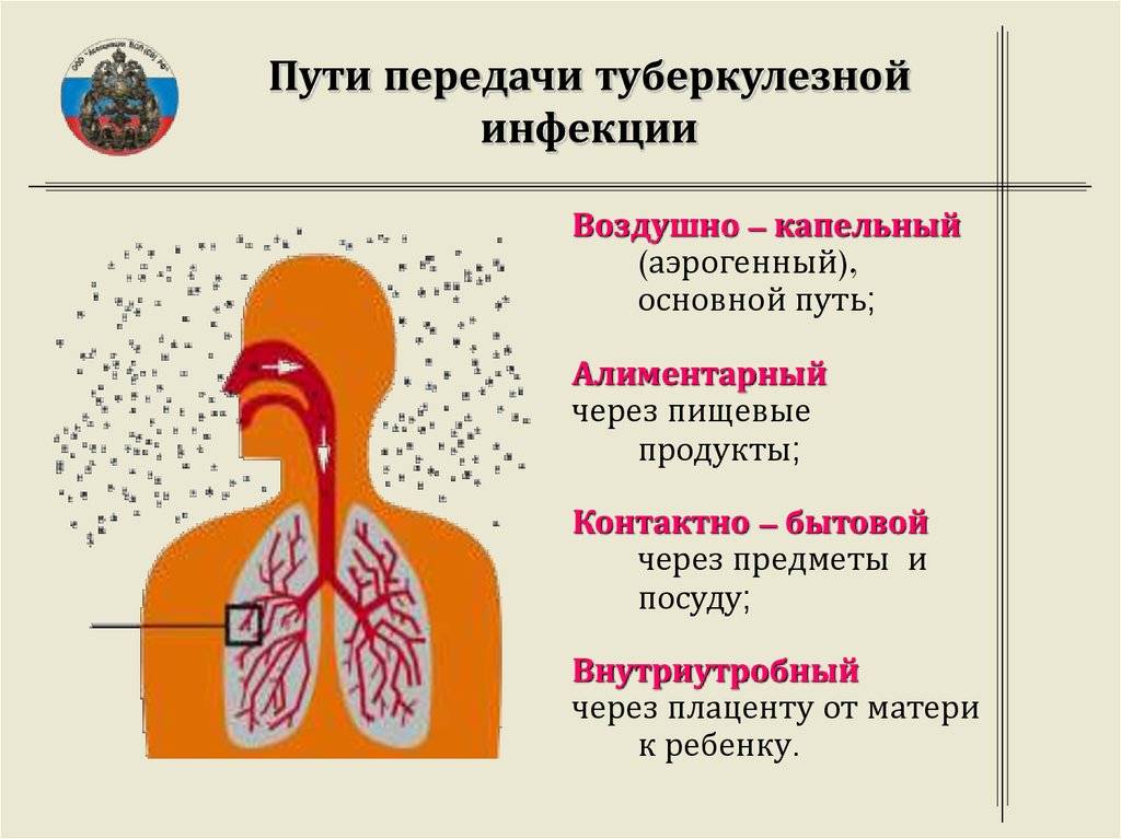 Туберкулез симптомы: 5 первых признаков туберкулеза легких у взрослых