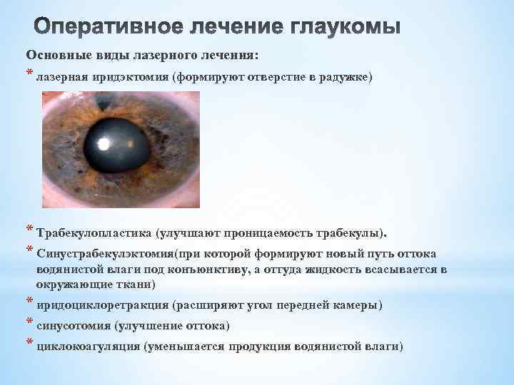 Иридэктомия: лазерная операция при глаукоме и восстановление в послеоперационный период
