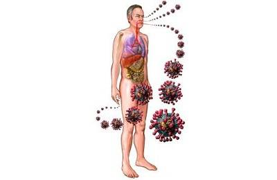 Как передается пневмония - заразно ли воспаление легких