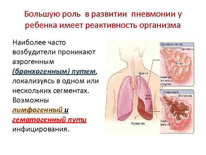 Симптоматика острой пневмонии