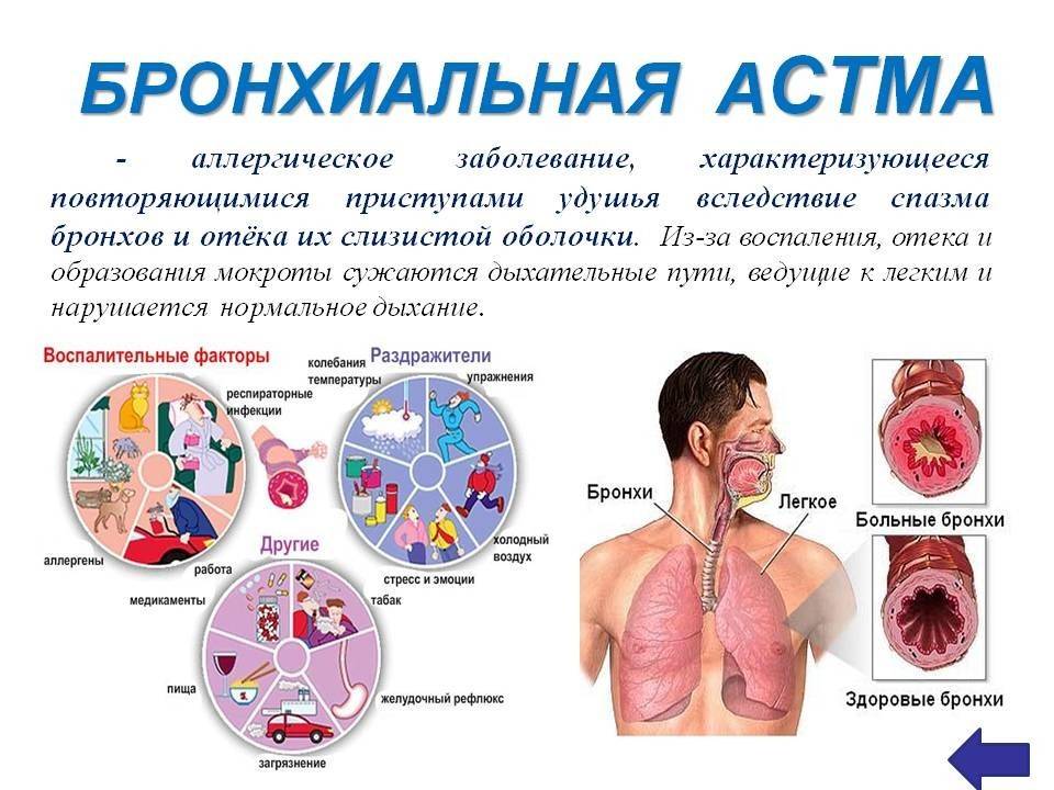 Бронхиальная астма у детей: симптомы и лечение, профилактика заболевания