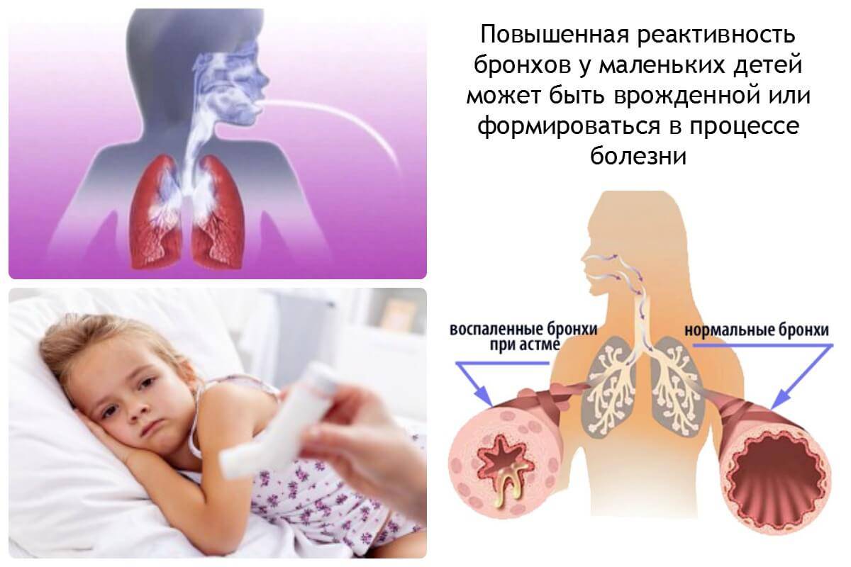 Пневмония у взрослых: симптомы и первые признаки, лечение, прогноз выживаемости
