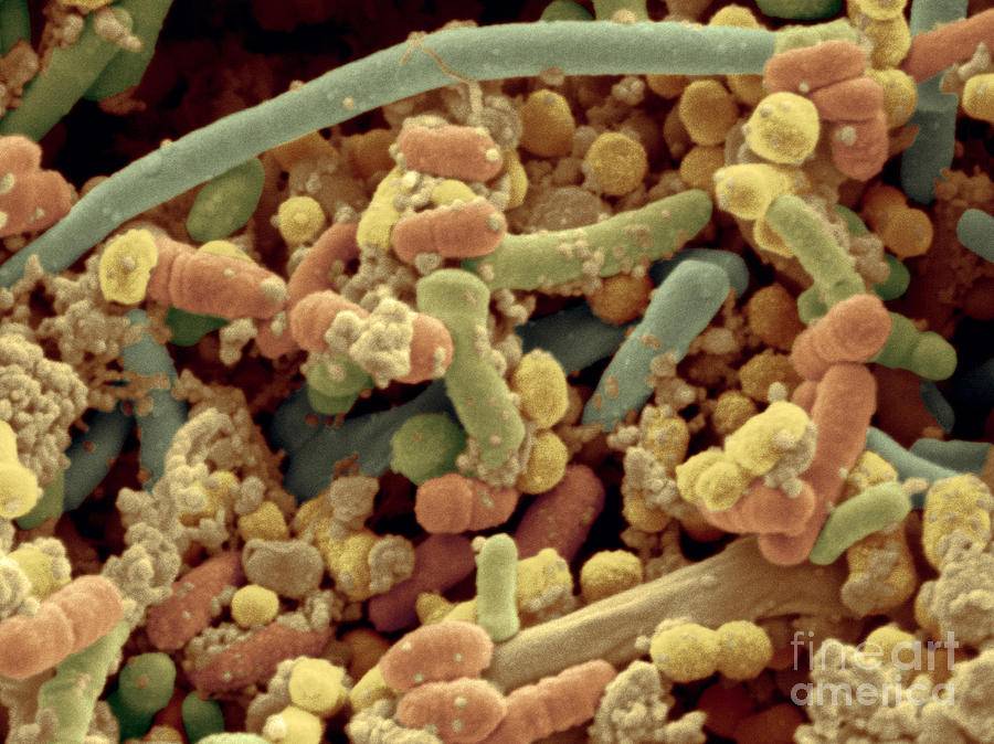 Streptococcus и гриб candida. а также дисбактериоз верхних дыхательных путей…