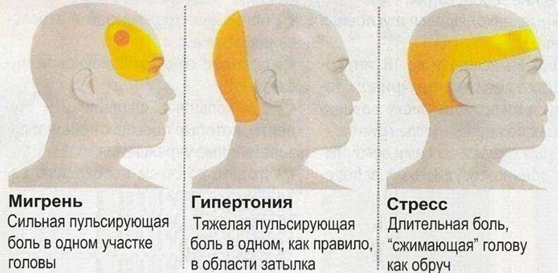 Болит голова сзади справа: причины головной боли в затылочной части