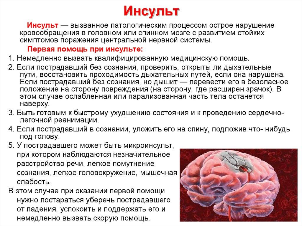 Профилактика инсульта головного мозга (первичная и вторичная): народные средства, препараты