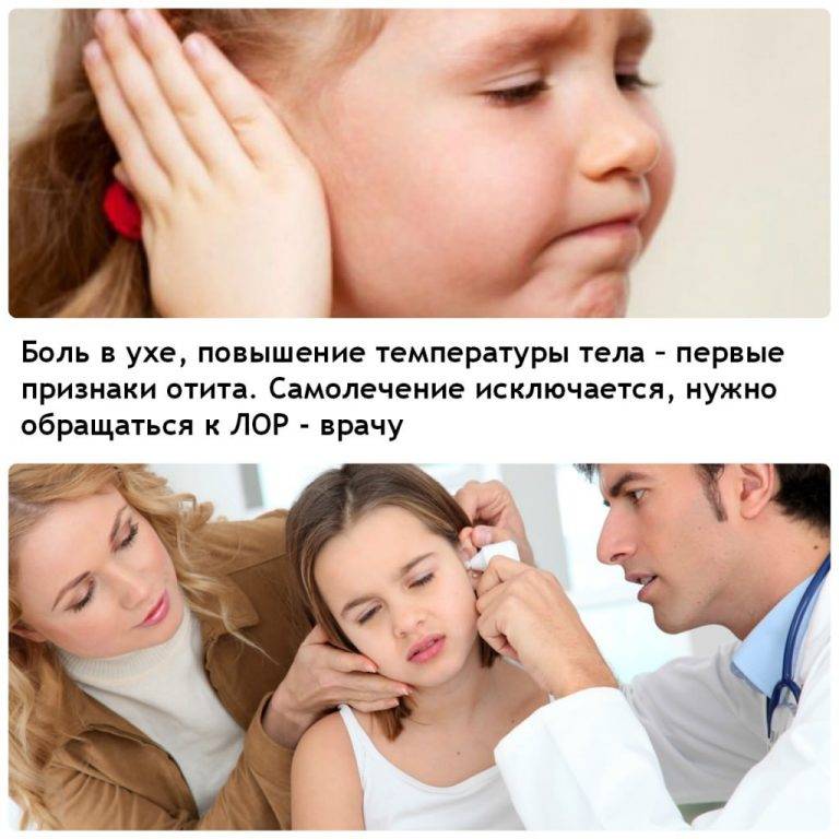 Отит у ребенка: лечение и симптомы воспаления уха у детей