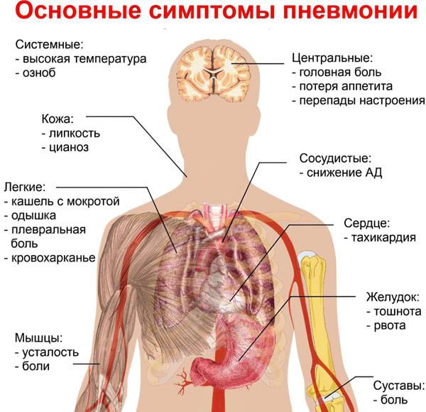 Признаки пневмонии у ребенка. особенности лечения. | pnevmonya.ru