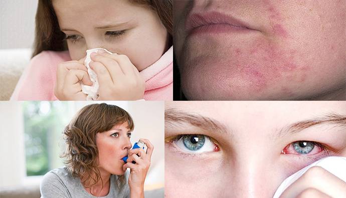 Аллергическая астма: симптомы у взрослых и детей. как лечились наши бабушки?