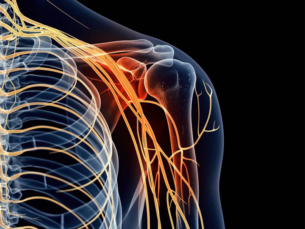 Невралгия плечевого нерва: симптомы, лечение