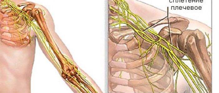 Неврит плечевого нерва: симптомы невралгии сустава руки и дальнейшее лечение