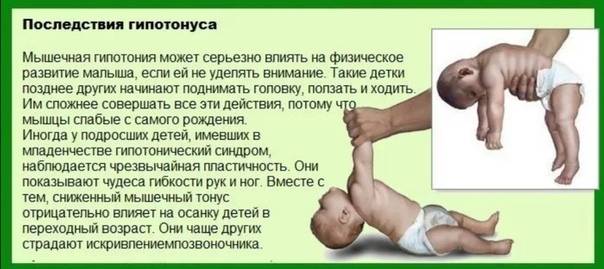 Синдром мышечной дистонии у ребенка-грудничка: детский массаж и гимнастика