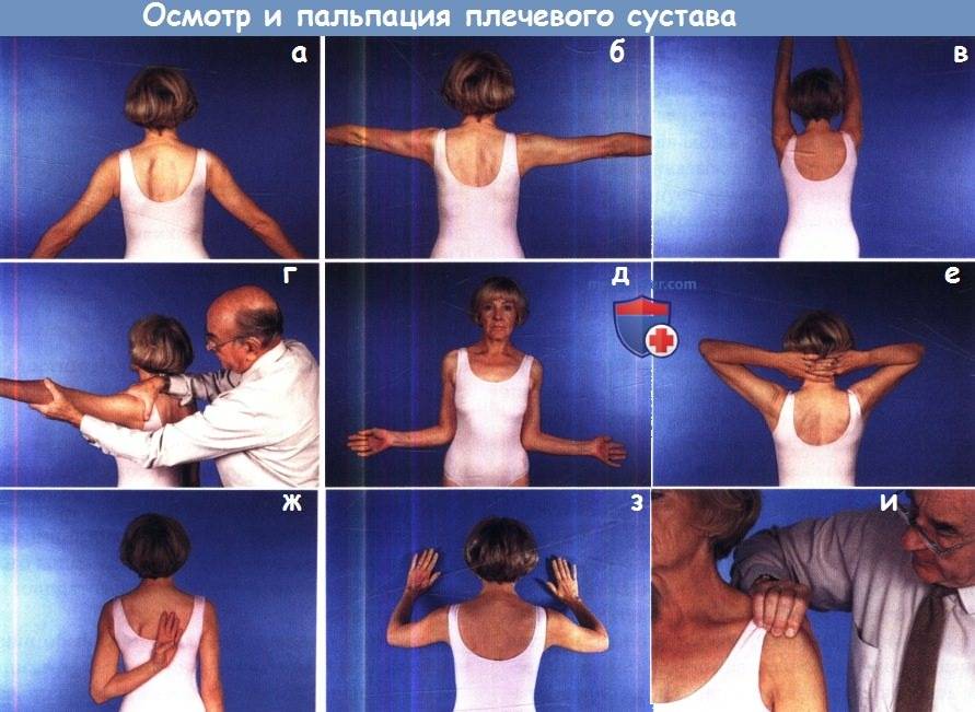 Полиартрит плечевого сустава – симптомы и лечение различными методами