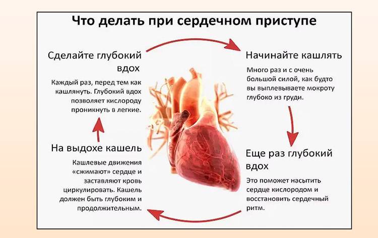 Сердечный кашель
