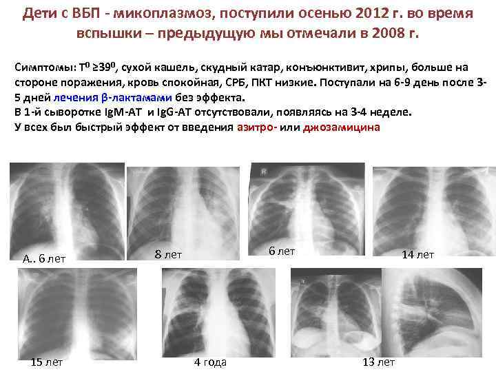 ✅ как облегчить кашель при пневмонии - vrach-med.ru